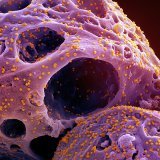 Tandis que notre protection contre les maladies infectieuses a augmenté depuis l'âge du bronze, ces mêmes mutations nous ont rendus plus vulnérables aux maladies auto-immunes et inflammatoires, selon une étude (image symbolique).